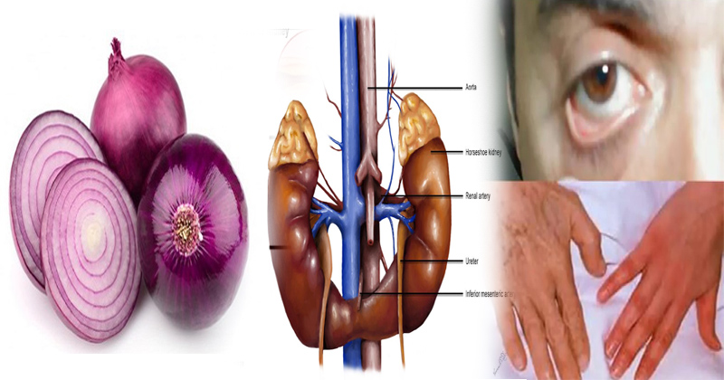 प्याज के लाजवाब फायदे, इन रोगों से बचाता है प्याज का सेवन, जानिए इस बारे में